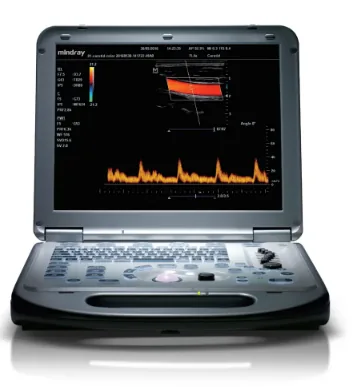 Mindray M58 — Seconds Boot & 1.5h Ultra-Long Battery POC Ultrasound