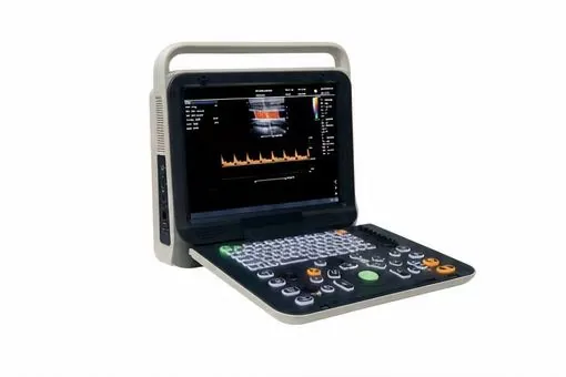 Shanson C5 — Portable color Doppler with multi imaging modes for full-department clinical diagnosis
